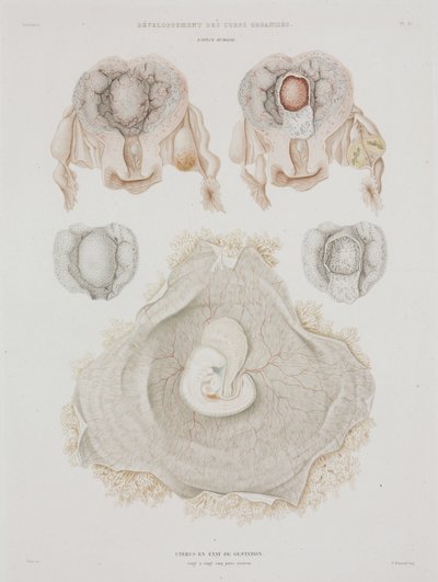 Gynécologie Utérus humain avec embryon, vers 1847-1859 - John Pardon