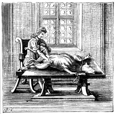 Transfusion de sang animal à humain, 1679 - Unbekannt