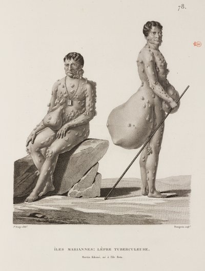 Maladies, maladies tropicales - Unbekannt