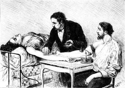 Le Dr Roussell de Genève effectuant une transfusion sanguine directe à une femme à partir d