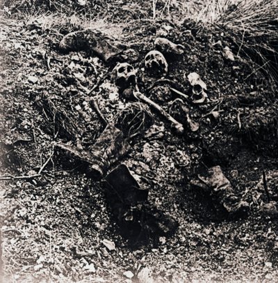 Restes humains, vers 1914-1918 - Unbekannt