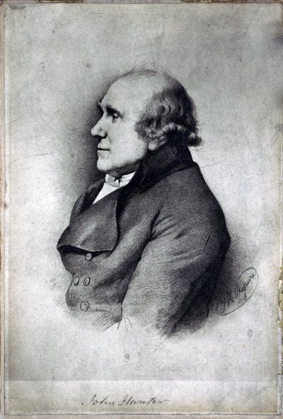 John Hunter, chirurgien et anatomiste britannique, vers 1770 - Unbekannt