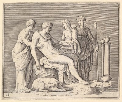 Homme assisté par trois femmes - Unbekannt