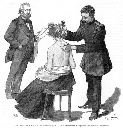 Le professeur Bergmann injectant un patient tuberculeux, 1891 - Unbekannt