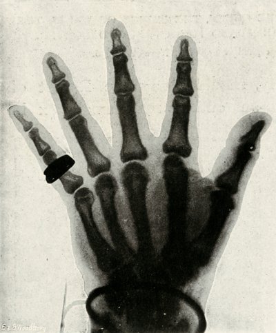 Radiographie de la main de S.A.R. le prince de Galles, vers 1897 - Unbekannt