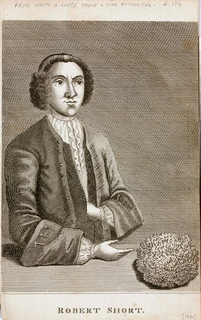 Robert Short, curiosité médicale, vers 1750 - Unbekannt