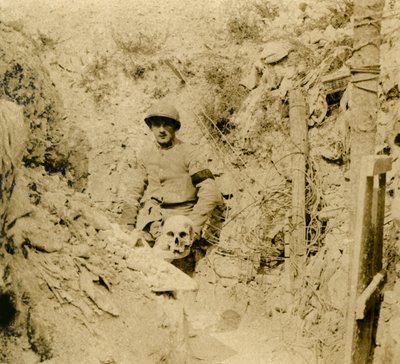 Crâne trouvé enterré dans les tranchées, vers 1914-1918 - Unbekannt