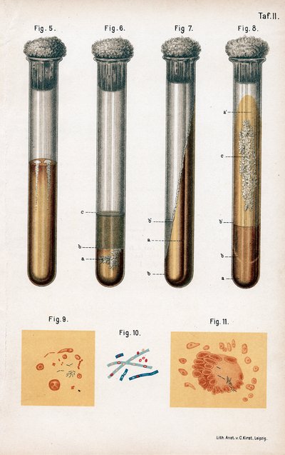 Divers types de bactéries, 1889 - Unbekannt