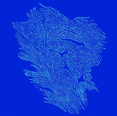 Section transversale de tumeurs fibro-nucléées - Unbekannter Künstler