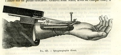 Sphygmographe direct - Unbekannter Künstler