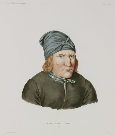 Maladies, Lèpre Femme lépreuse, Islande, début du 19ème siècle - Unbekannt