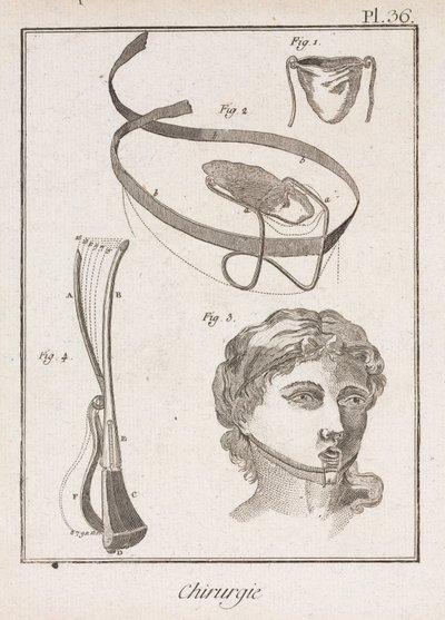 Dispositifs chirurgicaux pour les oreilles, le nez et la gorge - Unbekannt