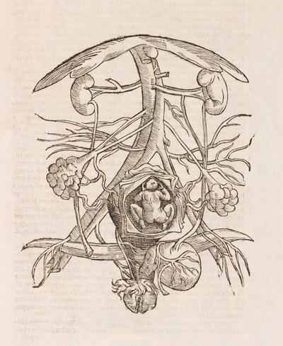Utérus avec un fœtus - Unbekannt