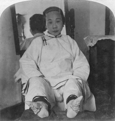 Les pieds délicats d