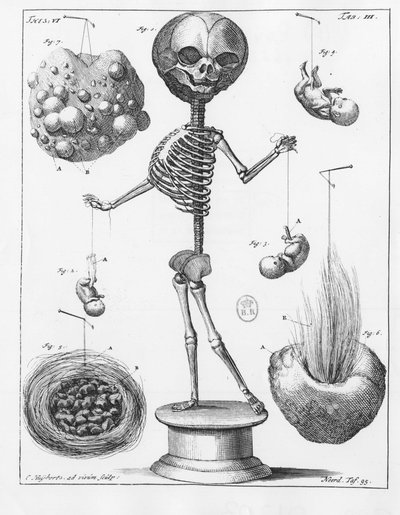 Planche anatomique représentant un squelette, par Frederik Ruysch (1638-1731), anatomiste néerlandais - Unknown artist