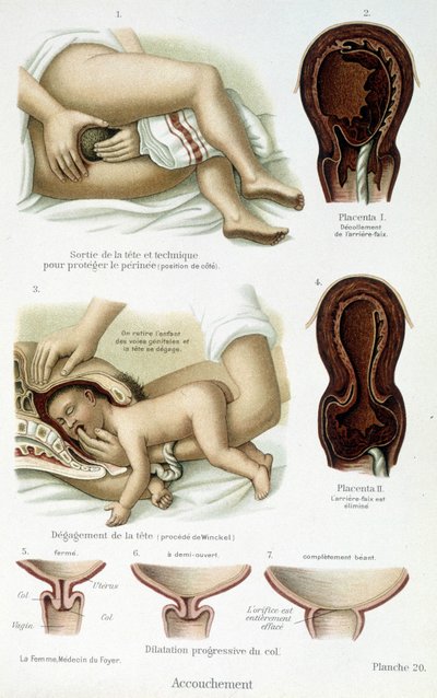 Accouchement - planche scientifique, fin XIXe siècle - Unknown artist