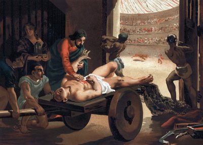 Claude Galien (Klaudios Galenos ou Claudio Galeno ou Claudius Galenus ou Galen, v. 131 - v. 201), médecin grec soignant un gladiateur. Barcelone 1881 - Unknown artist