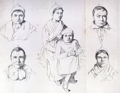 Considérations sur les causes du crétinisme endémique par Morel. - Unknown artist