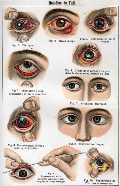 Maladies de l