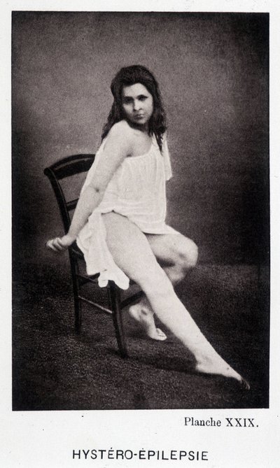 Hystéro-épilepsie - Contracture dans « Iconographie photographique de la Salpêtrière : service de M. Charcot » par Paul Regnard et Bourneville - Unknown artist