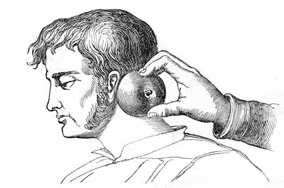 Saignée locale - application de sangsues avec une pomme - gravure dans « La Santé Universelle - Guide Médical des Familles » 1852 - Unknown artist