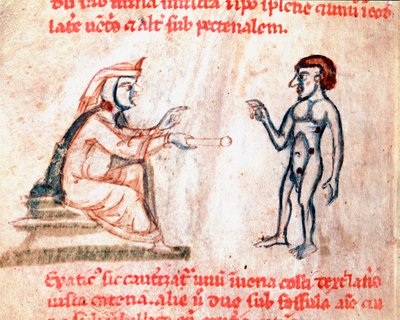 Le médecin brûle le patient sur des zones douloureuses avec des fers chauds Miniature du manuscrit "De Medicina cauteriorum secundum Brunum, Rugerium et Rolthe" XIIIe siècle Paris, B.N. - Unknown artist