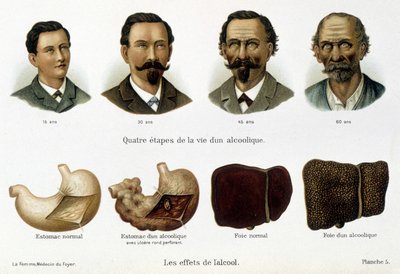 Les effets de l