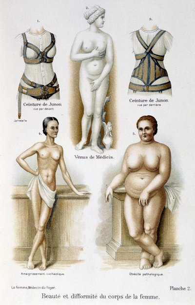 Beauté et difformité du corps de la femme (maigreur et obésité) ; Ceintures de Junon - dans « La femme, médecin du foyer » - Unknown artist