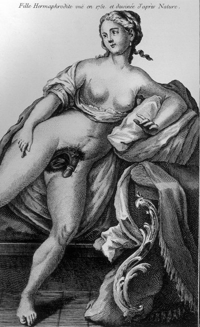 Fille hermaphrodite vue en 1751 et dessinée d