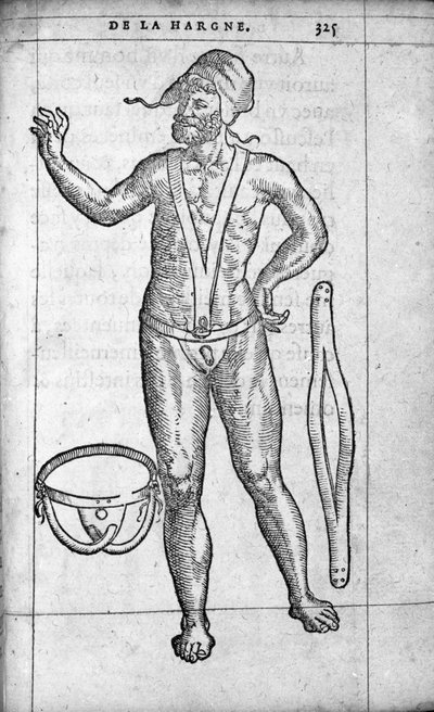 Médecine : une ceinture herniaire. Gravure de « De la hargne » par le médecin et chirurgien français Ambroise Paré (1509-1590) 16ème siècle - Unknown artist
