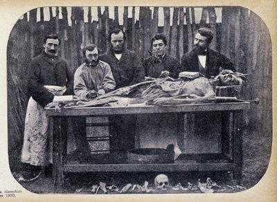 Dissection, v.1865 - Unknown photographer