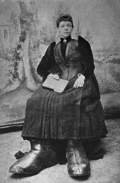 Les Monstres, Berthe aux grands pieds. Photographie, fin du XIXe siècle, Paris. Coll. Selva. - Unknown photographer