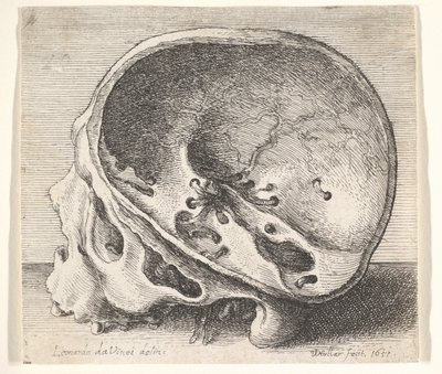 Crâne sectionné en profil à gauche avec le côté gauche du crâne enlevé, 1651 - Wenceslaus Hollar