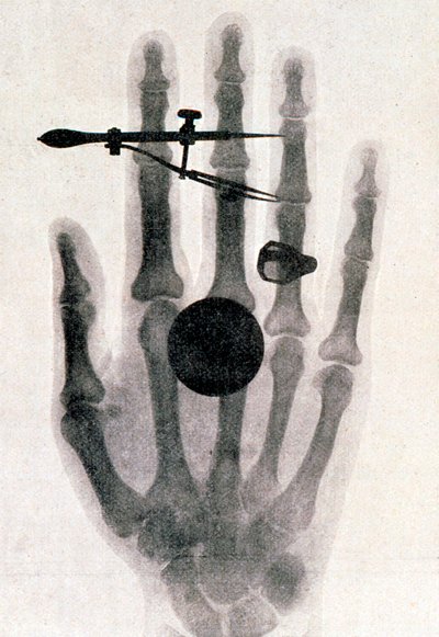 Radiographie de la main de la femme de Wilhelm Roentgen, 1896 - Wilhelm Conrad Rontgen
