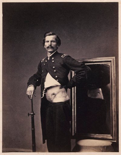 Major H. A. Barnum, rétablissement après une blessure par balle pénétrante de l