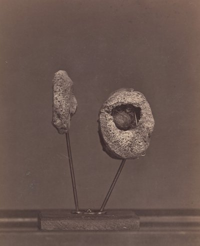 Articulation du genou excisée. Une balle de mousquet ronde dans le condyle interne du fémur droit - William H. Bell