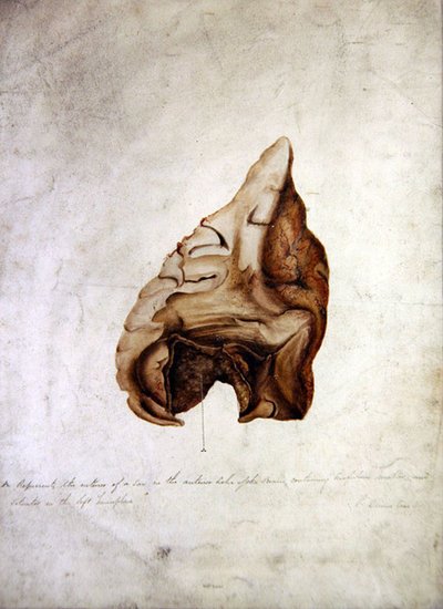 Étude du cerveau I, vers 1850 - William Lover