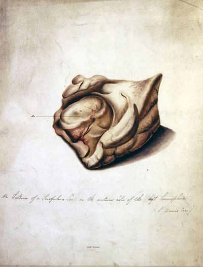 Étude du cerveau II, vers 1850 - William Lover