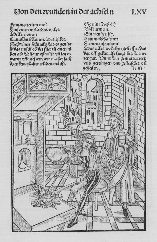 Le Livre de Chirurgie par Hieronymus Brunschwig - (after) German School