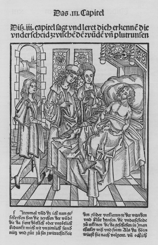 Le livre de Cirurgia par Hieronymus Brunschwig - (after) German School