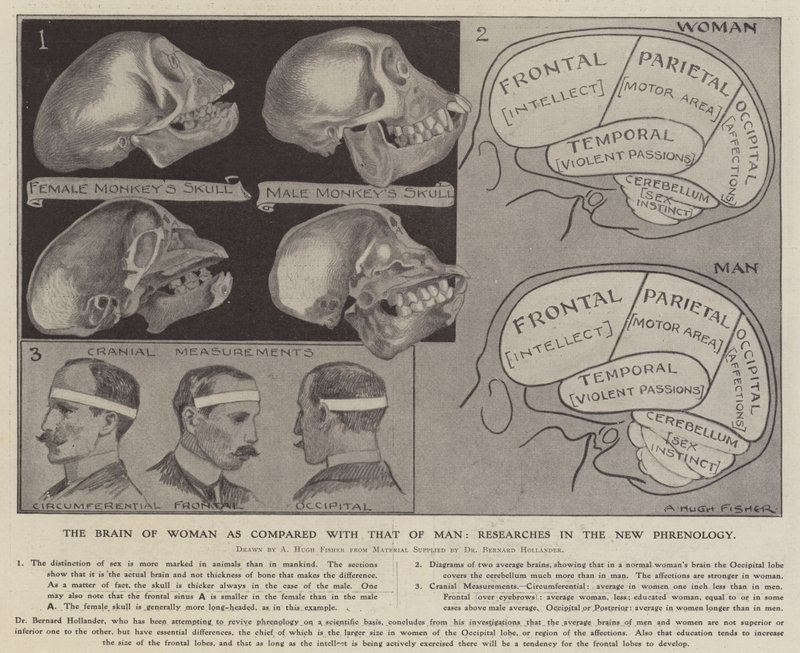 Le cerveau de la femme comparé à celui de l