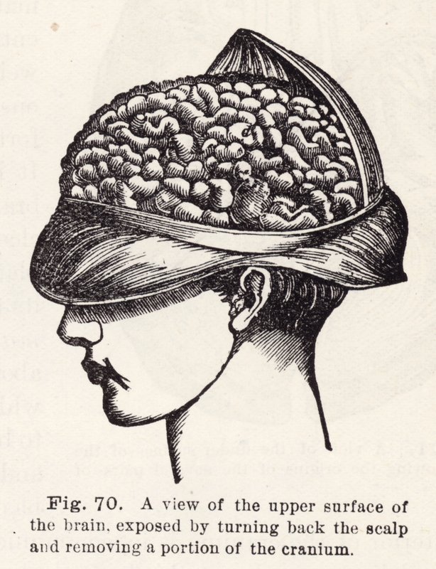 Vue de la surface supérieure du cerveau, exposée en retournant le cuir chevelu et en retirant une partie du crâne - English School