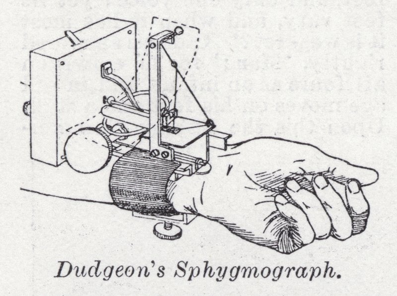 Sphygmographe de Dudgeon - English School