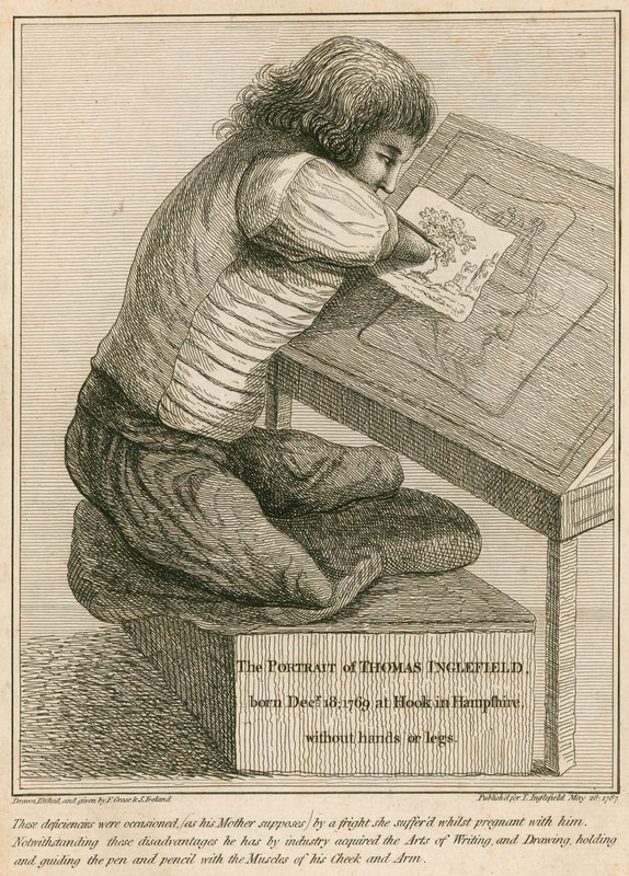 Thomas Inglefield, né le 18 décembre 1769 à Hook, Hampshire, sans bras ni jambes - English School