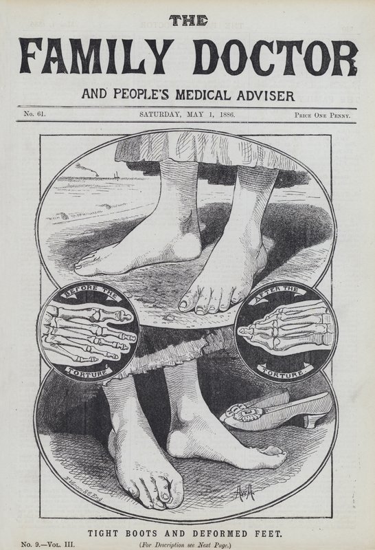 Bottes serrées et pieds déformés - English School
