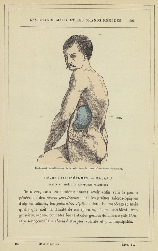 Gonflement caractéristique de la rate dans le cours d