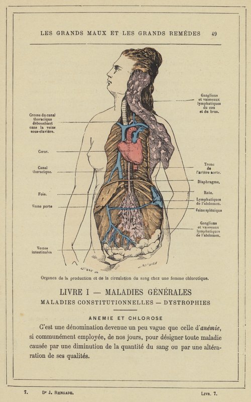 Organes de la production et de la circulation du sang chez une femme chlorotique - French School