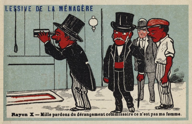 Rayons X - mille excuses pour le dérangement commissaire, ce n