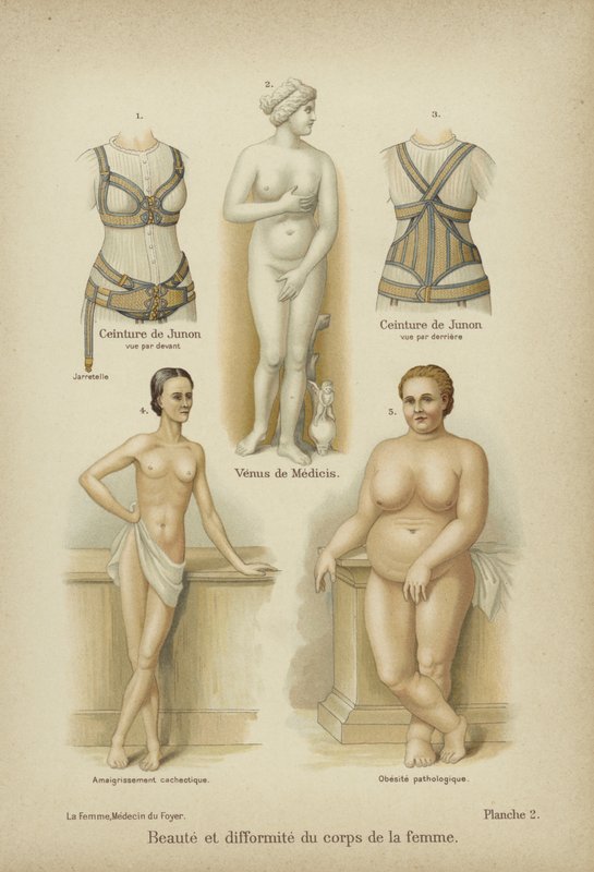 Beauté et difformité dans le corps féminin - German School