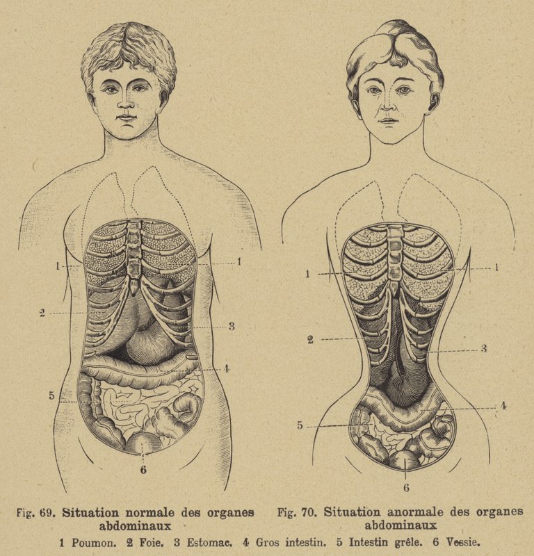 Situation normale des organes internes de l